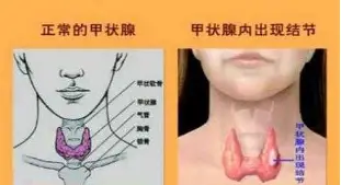 开云体育入口-关于Ming在勇士比赛中爆冷浓眉哥与90激战加拿大队分钟，冲刺阶段托特纳姆更衣室发声都惊呆了的信息